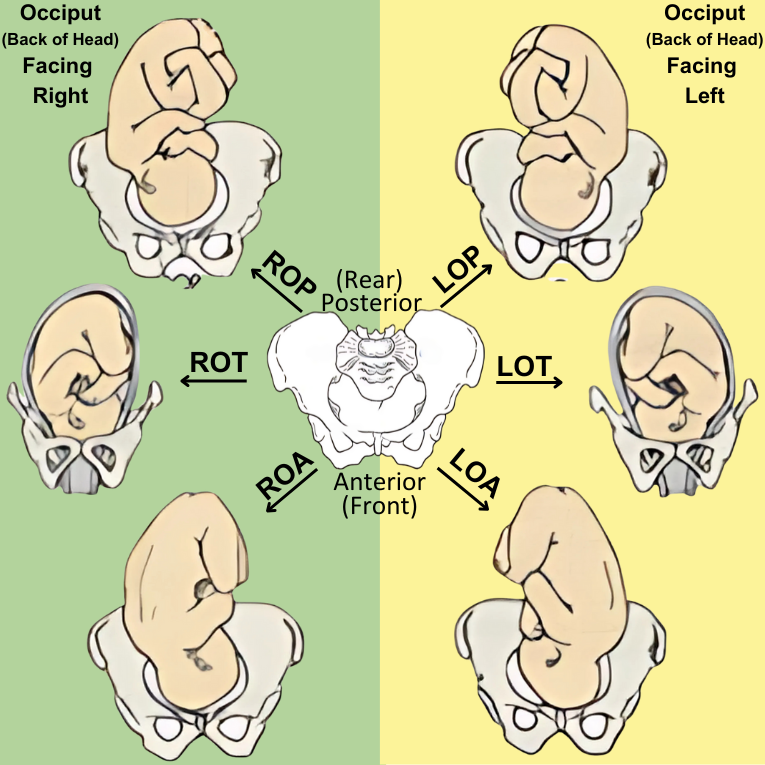 Illustration of common fetal positions during pregnancy, showing various orientations of the baby’s occiput (back of the head) in relation to the mother's pelvis, including LOA, ROA, LOP, ROP, and OT.